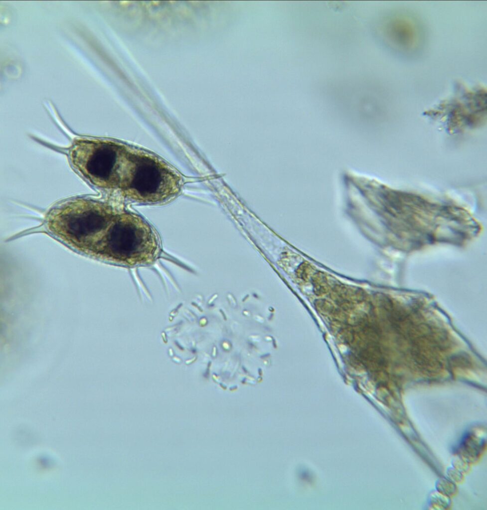 A desmid, blue green algae, dinoflagellate...