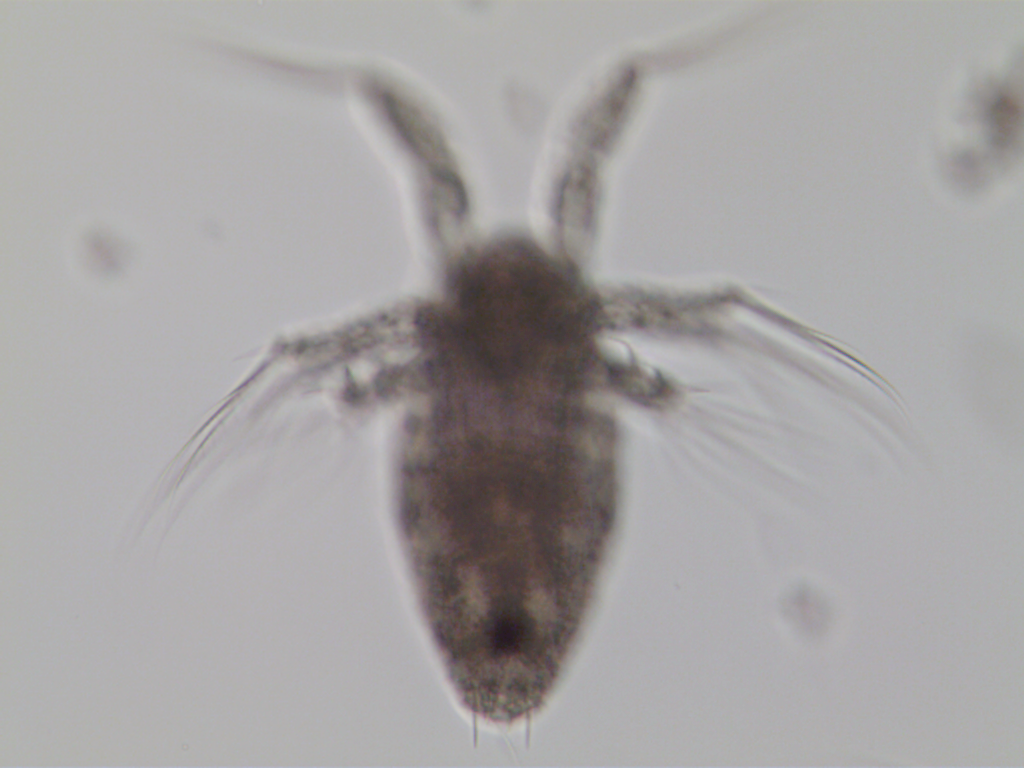 Acartia nauplius spines.