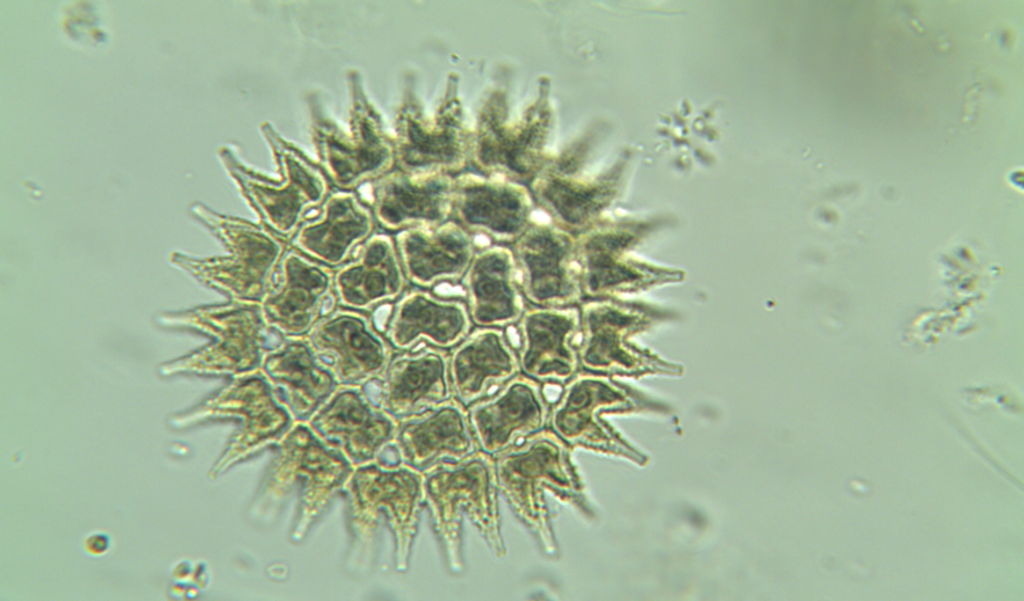 Pseudopediastrum boryanum